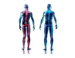 Myofascial